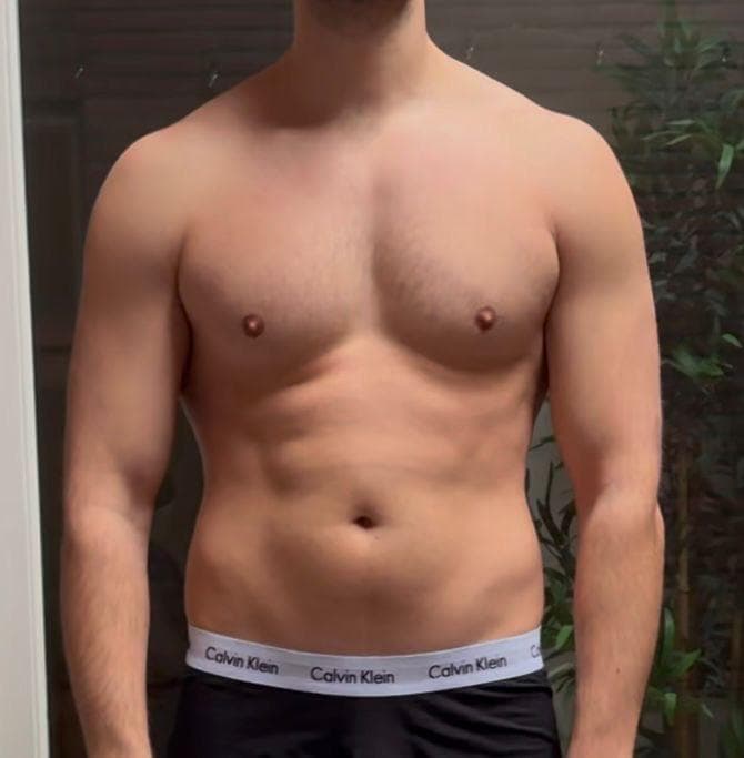 Darryn Before